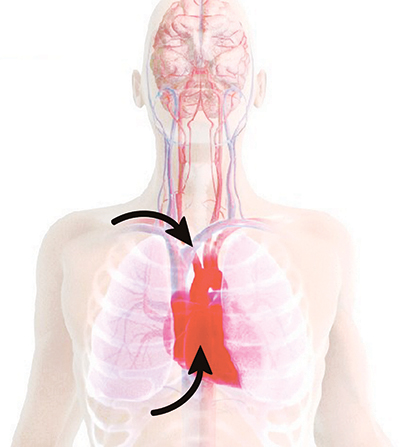 Illustration of increased blood flow to the heart