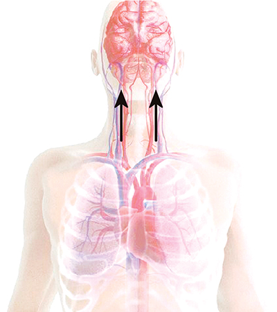 Illustration of blood flow to the brain