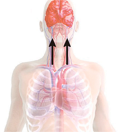 Illustration of increased blood flow to the brain