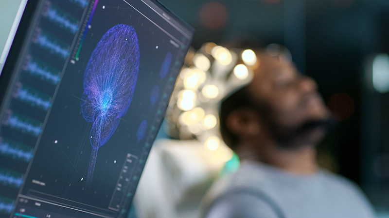 man getting a brain scan