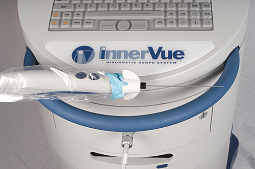 The InnerVue™ Diagnostic Scope System