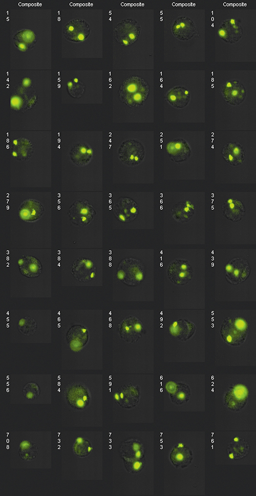 Extended depth-of-field (EDF) image of FISH probes