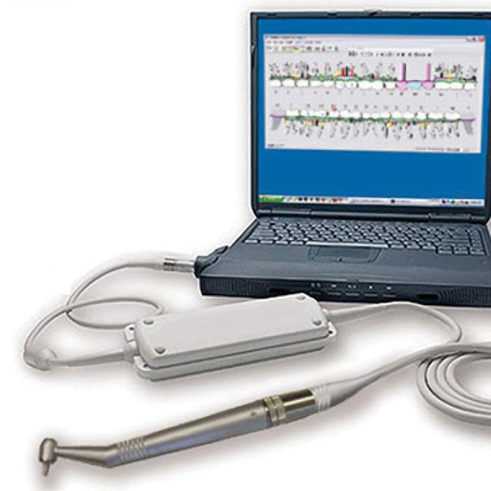 The USProbe device integrates with a laptop computer charting system