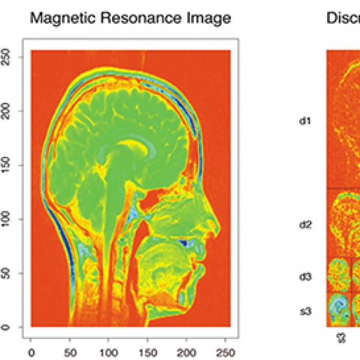 Magnetic Resonance image of a head and the discrete Wavelet Transform comparison