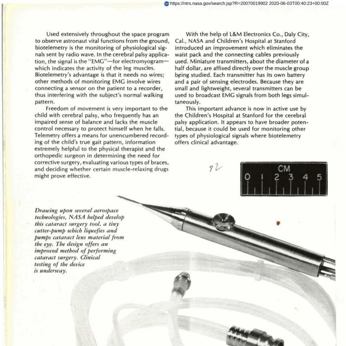 Cataract Surgery Tool