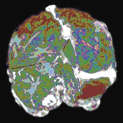 brain segment scan in color